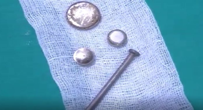 Shocking News: तीन वर्षांच्या एका मुलानं चक्क खिळा गिळला; डॉक्टरांनी केला चमत्कार