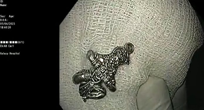 Shocking News: तीन वर्षांच्या मुलाने  हनुमान गिळला! डॉक्टरही झाले शॉक